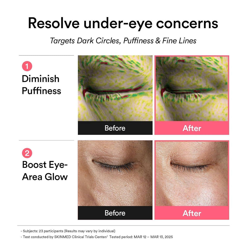 ABIB PDRN Retinal Hydrogel Eye Patches