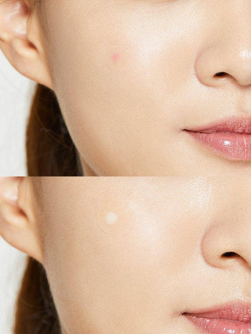COSRX Acne Pimple Master 24 Patches